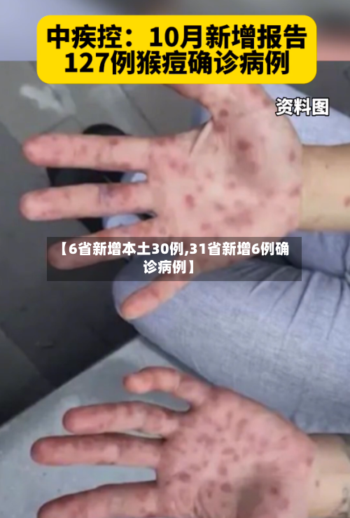 【6省新增本土30例,31省新增6例确诊病例】
